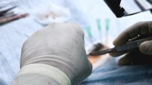 Pakistan Expands Healthcare Collaboration with Sri Lanka for Additional Cornea Donations
