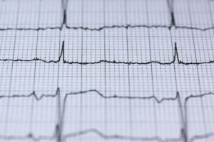 Sri Lanka Stent Withdrawals Raise Scrutiny Over Indian Medical Device Quality